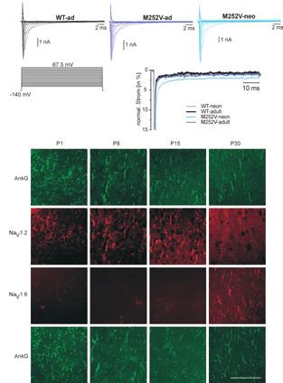 Mechanismen genetischer Epilepsien A B Abb. 3: SCN2A-Mutationen führen zur Steigerung der Kanalfunktion.