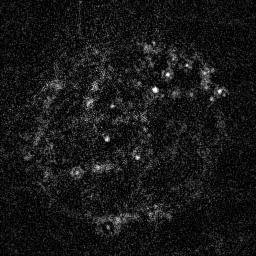 Aufgrund der Immobilisierung von mab414-atto655 ist die Oberseite des ovalen, schräg im Bild liegenden Zellkerns im ersten Bild gut zu erkennen.