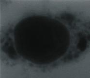 A Links: Fluoreszenzsignal der QD600-Impβ1. Die mit Pfeil markierte Zelle ist in C vergrößert dargestellt.