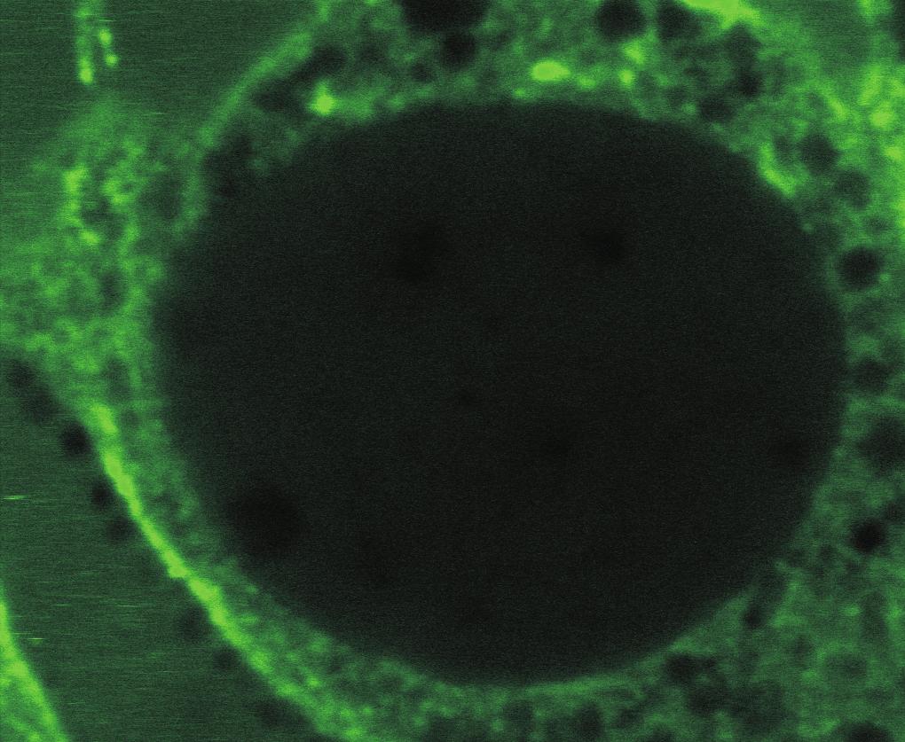 Der Zellkernbereich ist grau hinterlegt. C Diese zu Abbildung A analoge Darstellung zeigt die Vergrößerung eines Zellkerns.