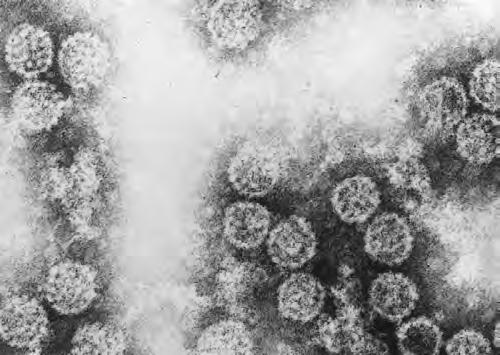 Polyomaviren bei Menschen BK-Virus im Urin