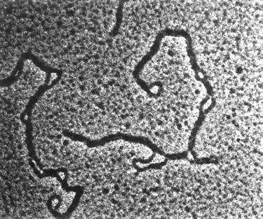 Struktur des Polyomavirus-Genoms Nukleosomen: Enthalten Histone
