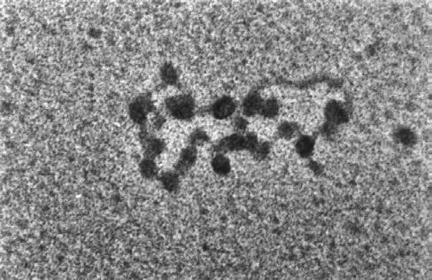 Minichromosom Elektronen Mikroskopische Aufnahme von SV40 DNA Aus Fields