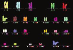 Labordiagnostik in der Pädiatrischen Genetik Klassische Chromosomenanalyse Standard-Untersuchungsverfahren.