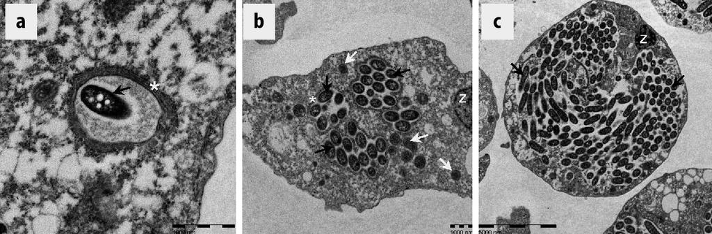 Mikrobiologie der Legionellen Legionella pneumophila in Hartmannella vermiformis Schwarze Pfeile: Legionellen; Weiße Sterne: Endoplasmatisches Retikulum; weiße Pfeile: Mitochondrien; Z: Zellkern