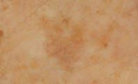 Dermatologische und klinische Studien beweisen: Erste sichtbare Milde r ung von Pigment flecken, ein ebenmäßigeres und strahlenderes Aussehen ab