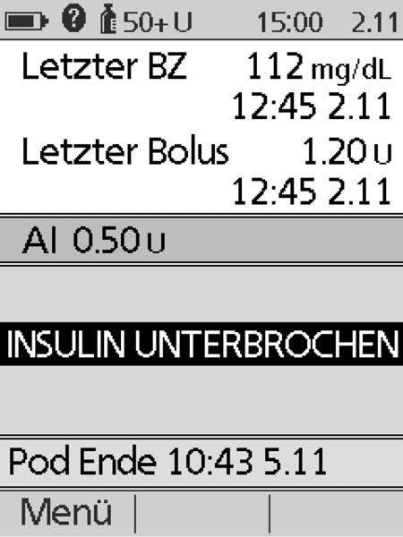 Verwendung des Pods 5 n Die Insulinabgabe unterbrechen Unter Umständen müssen Sie die Insulinabgabe kurz unterbrechen, z. B.
