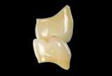 Seitenzähne Diese Zahnformenkarte erleichtert die Auswahl der Seitenzahn-Grössen, die zu den gewählten Frontzähnen passen.