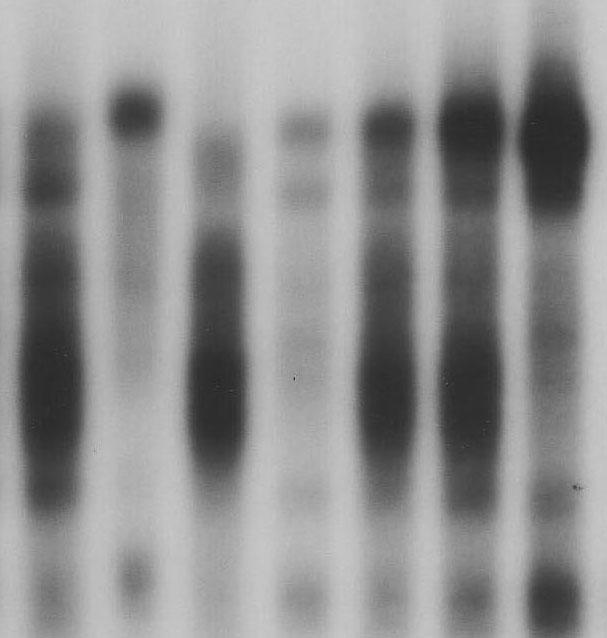 3 Ergebnisse 3), verblassten die MEF2-Bande, jedoch nicht die NFAT-Banden, was für eine unabhängige Bindung von NFAT an die DNA spricht.