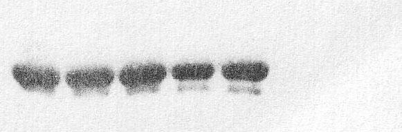 nur77-dmut ohne Oligonukleotid 1% der Proteinmenge 5% der Proteinmenge 1 2 3 4 5 6 7 C nur77-promotor-sequenz von 274 bp bis 247 bp Wildtyp: NFATmut: MEF2mut: dmut: 5 -CCGAGAGGAAAACTATTTATAGATCAAAG-3
