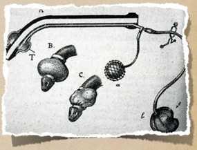 Vorgriff auf das Murphy- Eye Die direkte Laryngoskopie Alfred Kirstein,