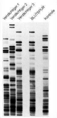 000 Zellkerne) 1. DNA-Isolation 2. Restriktionsverdau 3.
