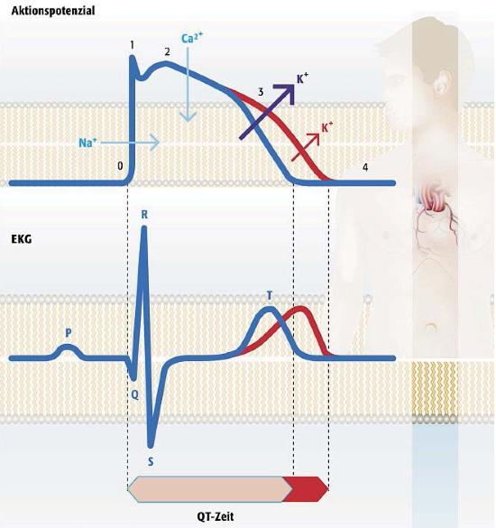 Abbildung 7: QT-Verlängerung im Aktionspotential und EKG Die Ursachen für den mangelnden Transport sind höchst komplex.