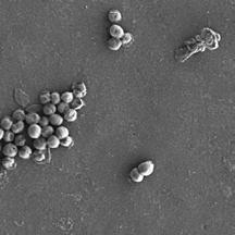In-vitro-/Ex-vivo-Wirksamkeit Die Verringerung mikrobieller Adhäsion und Besiedelung an Geräteoberflächen wurde für klinisch relevante Stammkulturen mithilfe eines In-vitro-Wirksamkeitstests