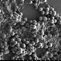 Exemplarische Ergebnisse (Staphylococcus epidermidis) werden in den folgenden Abbildungen dargestellt 15. Weniger Bakterien haften an der beschichteten Bactiguard-Oberfläche.