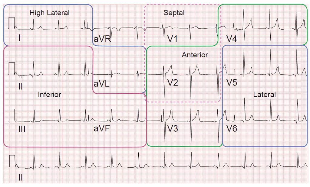 EKG und Herzregion