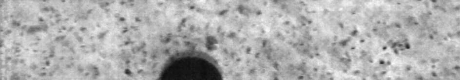 Aufnahmen mit Tracer im Zeitabstand von t=2s Der Bildausschnitt beträgt 1,5 mm Auf der Bildüberlagerung kann man die Bewegung der Blase sehen, man erkennt aber nicht die Tracerbewegung Für die