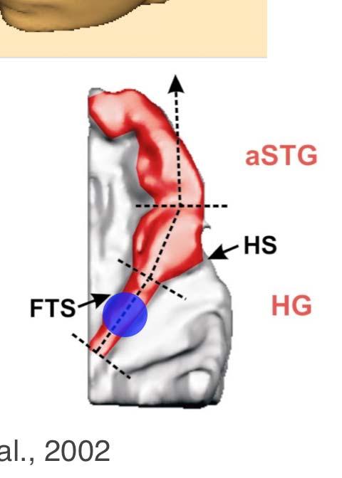 Musikalität - Anatomie - Physiologie Auditorisch evoziertes Feld im primären