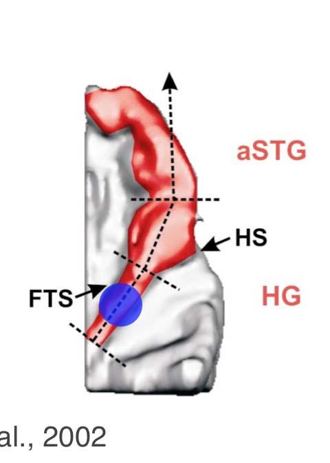 Musikalität - Anatomie - Physiologie Auditorisch evoziertes Feld im primären auditorischen Kortex