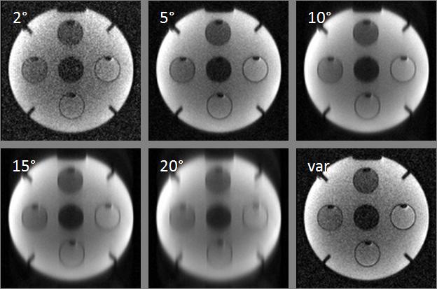34 Kartesische turbosteam-sequenz Abbildung 3.5: Konstant gehaltene α-auslesepulse verursachen bei zu großer Wahl der α- Kippwinkel Verschmierungen im Bild.