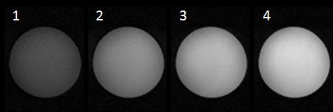 54 Parameteroptimierung für die turbosteam-sequenz Abbildung 4.8: Durch die Segmentierung des k-raums ist eine Verbesserung im SNR in den Bildern zu erkennen: 1 Segment (SNR) = 27, 2 Seg. = 47, 3 Seg.