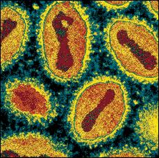 Bioterrorismus auf der Welt