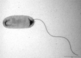 Vibrionen - Übersicht Gramnegative aquatische Bakterien Ubiquitär verbreitet in marinen Ökosystemen Sediment, freies Wasser, assoziiert mit aquatischen Organismen Pathogenität Gastrointestinale