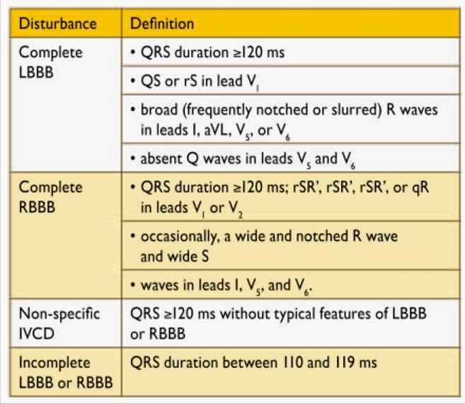 LBBB und Mortalität Gesamtmortalität nach CRT QS oder rs in V1 QRS Dauer 140ms (m) 130 ms (w) QRS