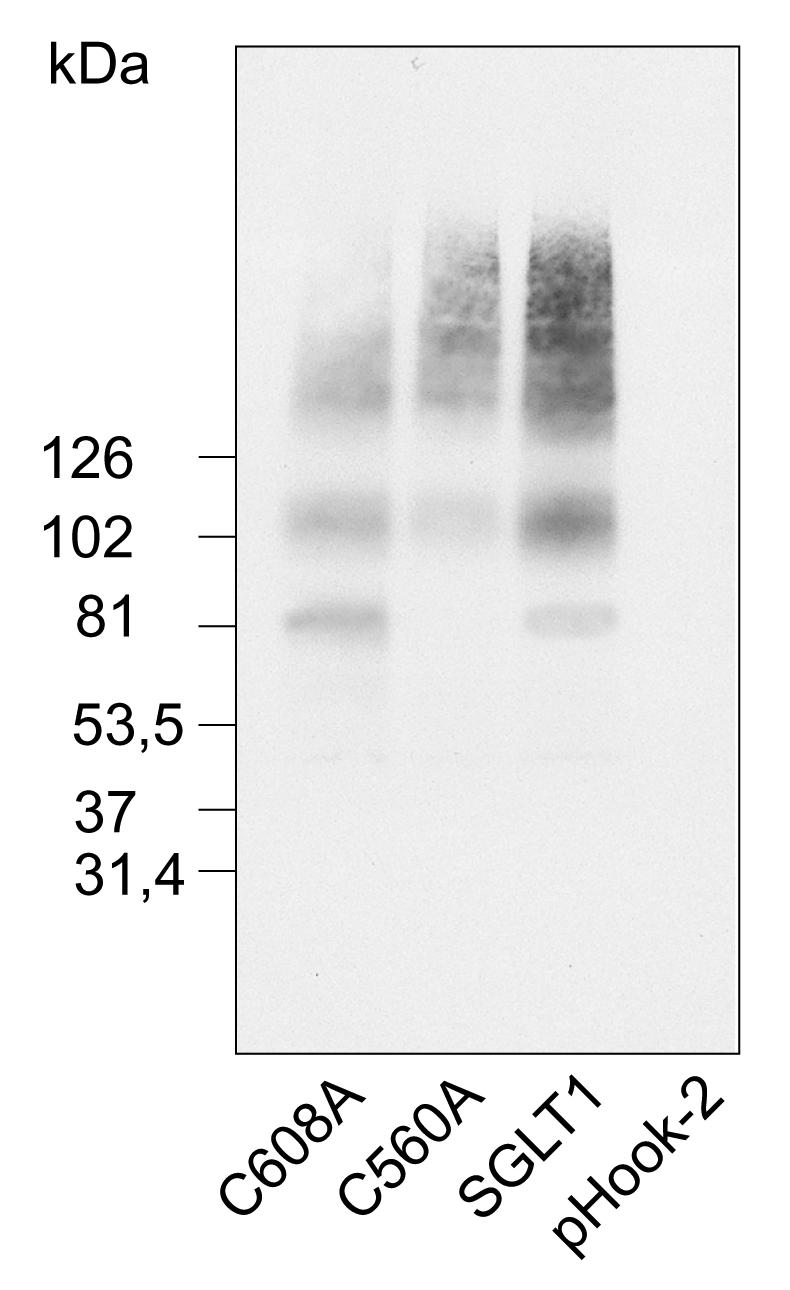 4. Ergebnisse Die RNAs der drei verschiedenen Transporter wurden nach der Transfektion in einem Verhältnis von : 0,5 ± 0,03 : 0,7 ± 0,04 in COS-7 Zellen exprimiert.