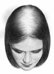 Anwendungsgebiete Regaine Frauen stabilisiert bei Frauen den Verlauf der androgenetischen Alopezie vom weiblichen Typ (charakteristische anlagebedingte diffuse Kopfhaarverdünnung im Scheitelbereich).