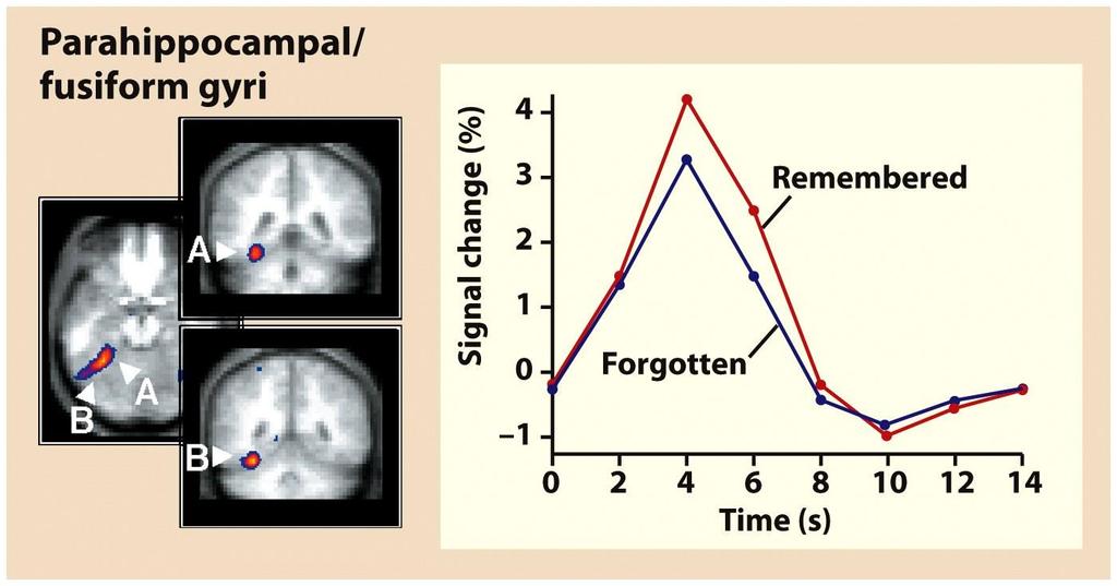 parahippocampal region exhibit greater activity during encoding for words