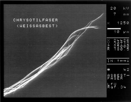Fasern Definition (WHO): faserförmige Staubpartikel, Länge 5 µm Durchmesser < 3 µm, Verhältnis L:D 3:1 Wirkung: Langgestreckte Staubteilchen haben (bei hoher Biobeständigkeit) krebserzeugende