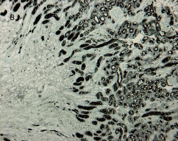 In der kontralateralen Niere ist die Morphologie der Tubuli erkennbar, in der ischämischen nicht. Dort sieht man im OSOM schwarz gefärbte Konglomerate anstelle von Tubuli.