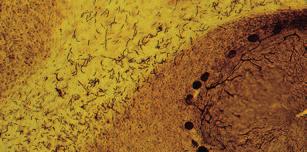 Schnittpräzision der Extraklasse Mikrotome mit vibrierender Klinge werden zum Schneiden einzelner Zellschichten oder stärkerer Schnitte von fixiertem oder frischem Gewebe unter physiologischen