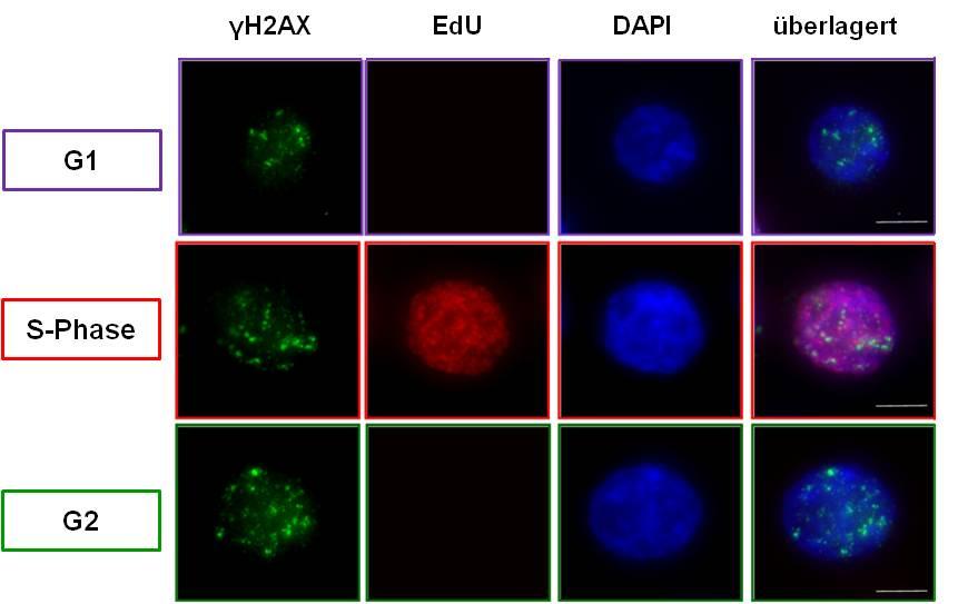Eingezeichnet sind die Markierungen für die G1, G2 und S Phase. B. Fluoreszenzmikroskopische Aufnahmen der verschiedenen Zellzyklusphasen der in A abgebildeten WT Zellen.