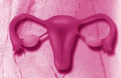 sterili Eileiter Die weiblichen Geschlechtsorgane Eierstock Gebärmutter Die Gebärmutter Von einer Endometriose am häufigsten befallen sind die Gebärmutter, Eileiter, Eierstöcke sowie das umgebende