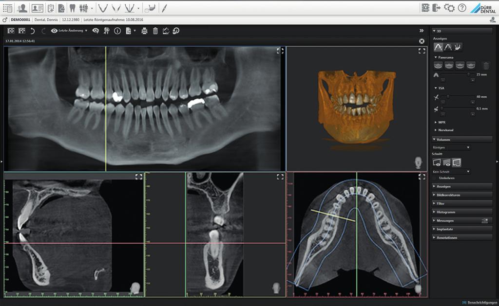 VistaSoft die Diagnostikzentrale Ihrer Praxis Die Dürr Dental VistaSoft vereint 3D- und 2D-Röntgenaufnahmen ebenso wie Kamerabilder oder Bildimporte aus Drittanbieter-Hardware sowie von Überweisern.