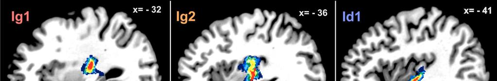 - Ergebnisse - Abb. 23: Die Wahrscheinlichkeitskarten der Areale Ig1, Ig2 Id1 zeigen die inter-individuelle Variabilität über alle zehn kartierten Gehirne im anatomischen MNI-Referenzraum.