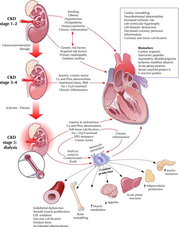 CRS 4 Chronisches renokardiales Syndrom Typ 4 Chronische Nierenerkrankung verschlechtert kardiale Funktion: