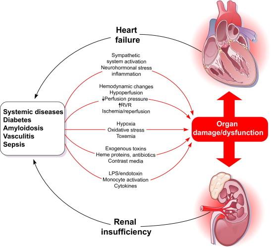CRS 5 Sekundäres kardiorenales Syndrom Typ 5 Systemerkrankungen führen zu parallelen, unabhängigen Schädigungen von