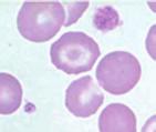 und peripheres Blut Eingeschnürtes Zytoplasma des Megakaryozyten Junger Thrombozyt im peripheren Blut mit RNA Retikulierter