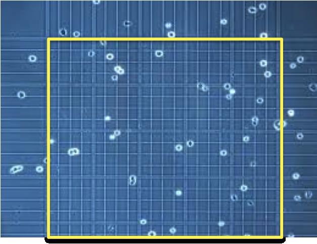 Neubauer-improved Kammer Platzieren Sie die Kammer unter dem Mikroskop und zählen Sie die Zellen im mittleren Quadrat (innerhalb der gelb markierten Fläche).