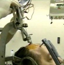 3000 Patienten in Deutschland haben bereits einen Hirnschrittmacher. Bildquelle: www.charite.