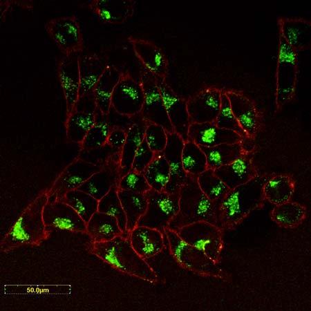 4 Ergebnisse und Diskussion 59 Abbildung 4.8 Fluoreszenzspektroskopische Aufnahme von Mesenchymalen Stammzellen (MSCs) nach Aufnahme von VHPM10.