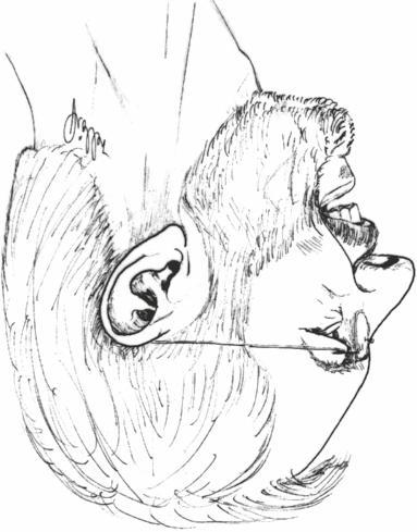 1 Einstelllinien Schädel a b c a Ohrvertikale (Aurikularlinie: Verbindung der beiden äußeren Gehörgänge, teilt Schädel in zwei Hälften) b Augen-Ohr-Linie (Kanthomeatallinie: