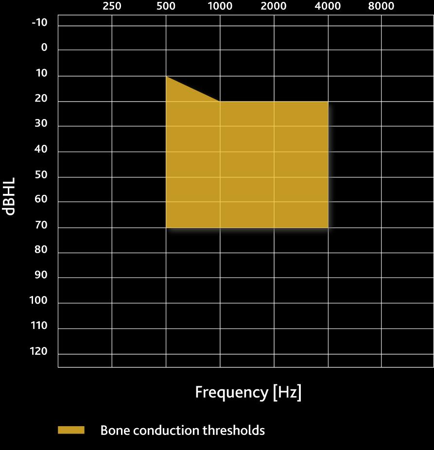 Cochlear Carina System Indikation bis zu 85 db SNHL Für