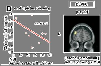 im DLPFC und im linken OC je höher der