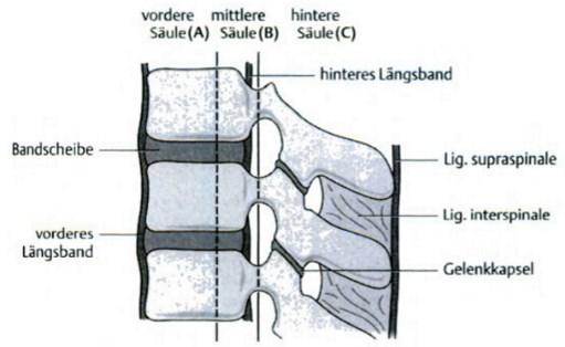 Die drei Säulen wurden wie folgt eingeteilt in: vordere Säule: ventrale 2/3 des Wirbelkörpers mit Bandscheibe und Lig.