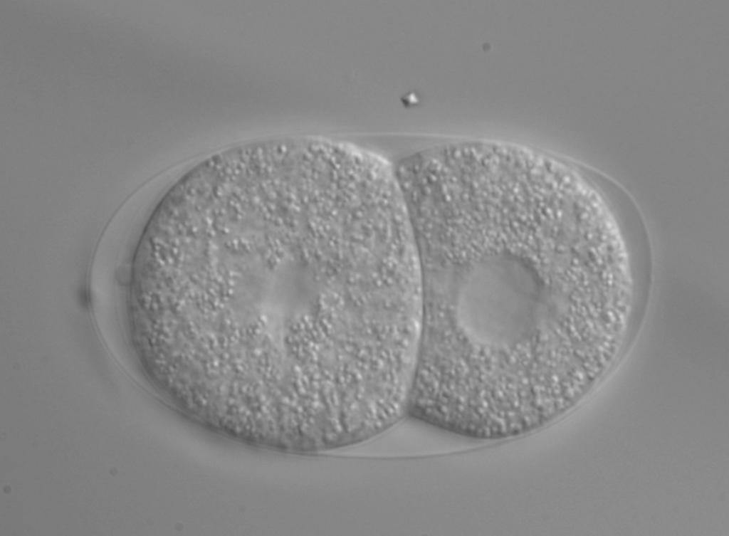 Abbildung 11: Übersicht der Entwicklung von C. elegans. Das linke Bild zeigt einen 2-Zeller zu Beginn der Aufnahme.