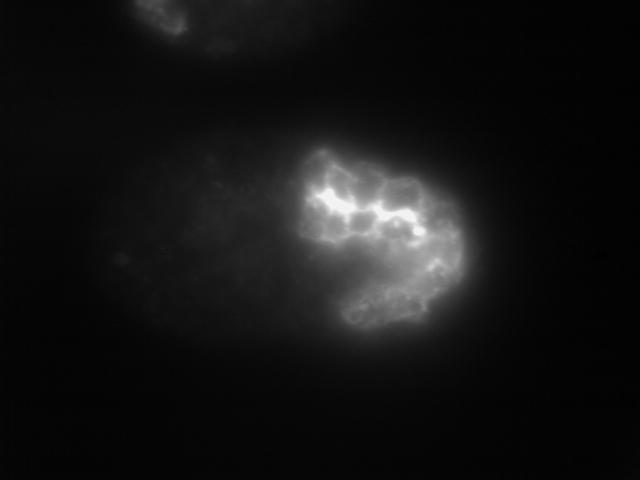 Am Ende des prämorphogenetischen Stadiums, zu Beginn der Morphogenese, wird der Embryo komplett von Hypodermis-Zellen umgeben, wobei einige Zellen fusionieren (*) und ein Synzytium bilden.